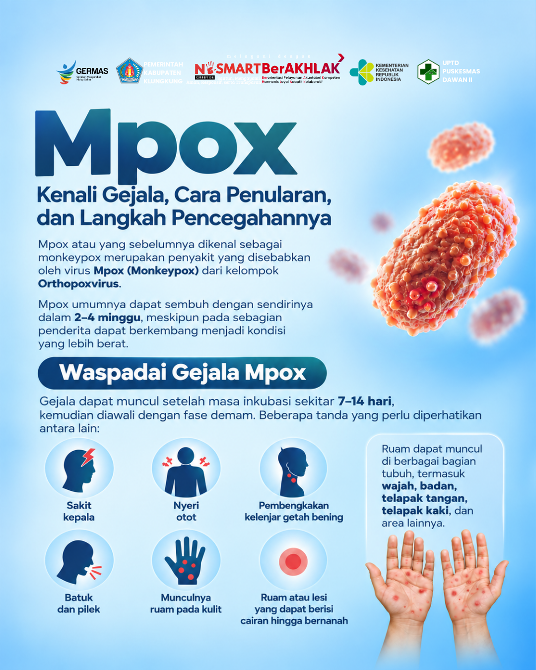 Waspada Mpox! Kenali Gejalanya Lebih Awal